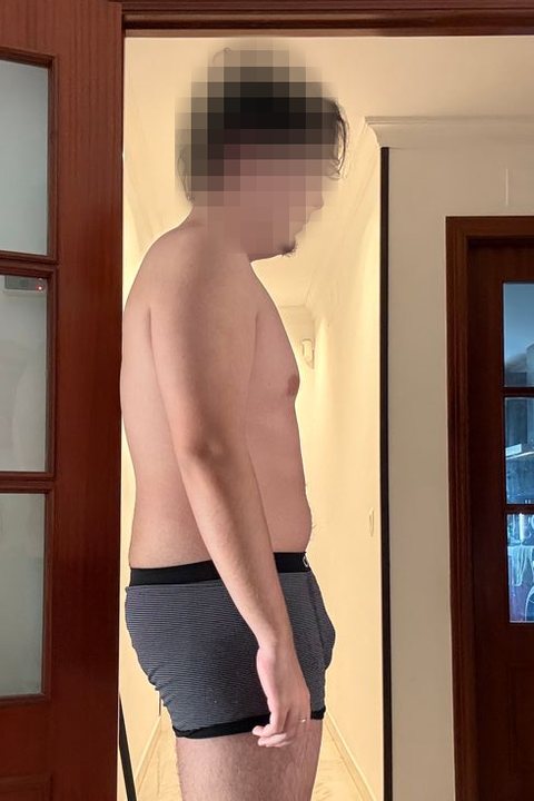Alejandro de perfil, al empezar (16/03/2026); cara pixelada